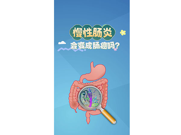 科普在線丨慢性腸炎會(huì)變成腸癌嗎？