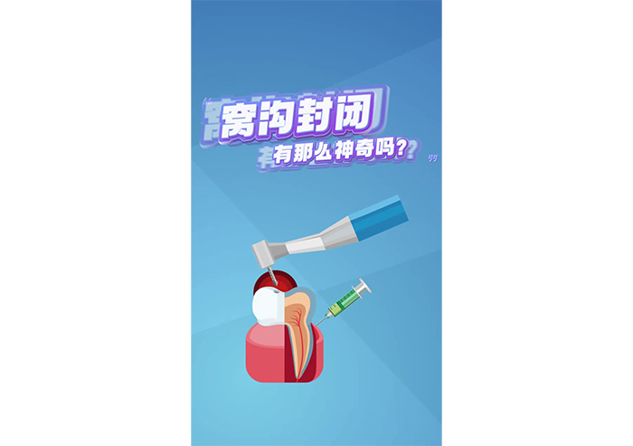 窩溝封閉有那么神奇嗎？